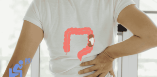 Colon Cancer Lowback