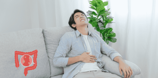 Colon Cancer40