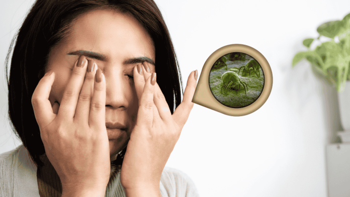 Demodex Blepharitis