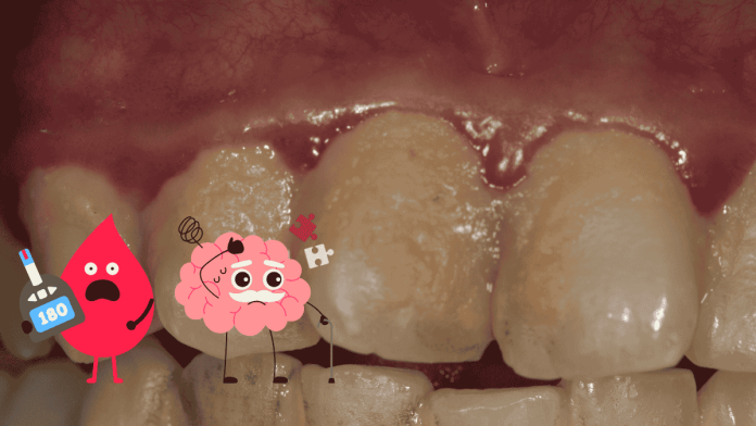 Dental Plaque