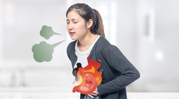 口臭病因之一是胃食道逆流