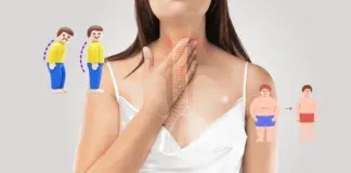 gerd-causes-h-pylori-eradication-obesity-posture