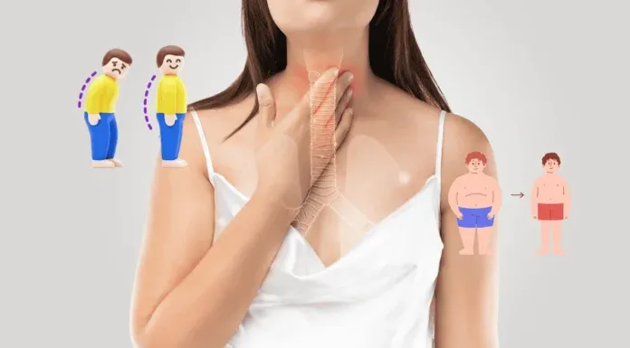 gerd-causes-h-pylori-eradication-obesity-posture