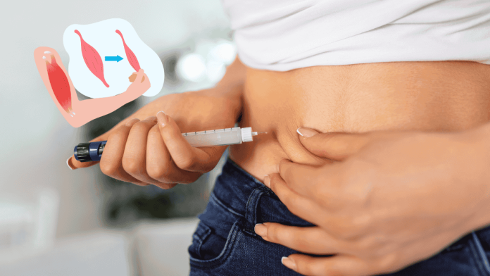 Glp1 Weight Loss Muscle Loss