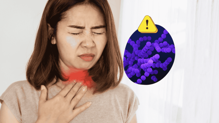 Group A Streptococcus