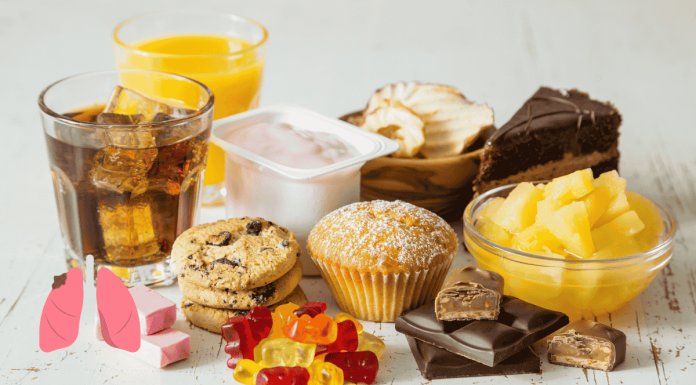 High Sugar Diet