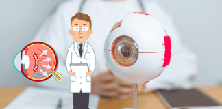 How To Prevent Glaucoma