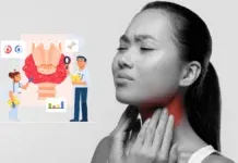Nasopharyngeal Carcinoma Npc Symptoms Ebv Prevention