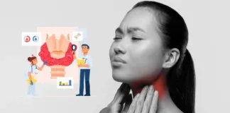 Nasopharyngeal Carcinoma Npc Symptoms Ebv Prevention