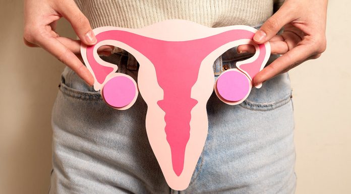 Ovarian Cancer