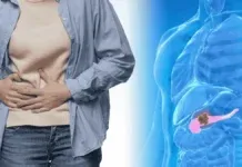 Pancreatic Cancer Symptoms Fatty Stool New Drug Insurance