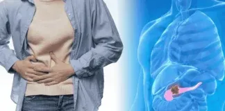 Pancreatic Cancer Symptoms Fatty Stool New Drug Insurance