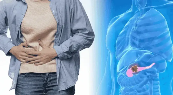 Pancreatic Cancer Symptoms Fatty Stool New Drug Insurance