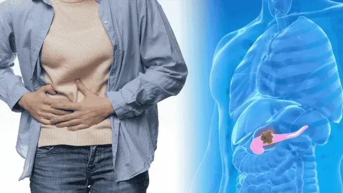 Pancreatic Cancer Symptoms Fatty Stool New Drug Insurance