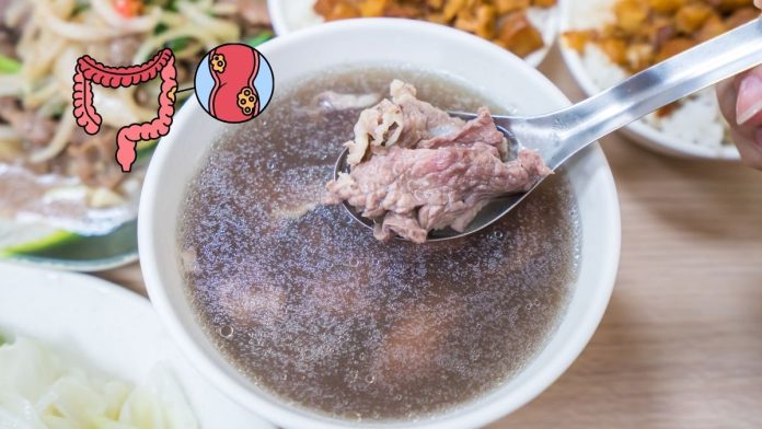 Red Meat Colon Cancer Risk Beef Soup