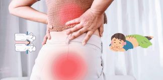 Sciatica