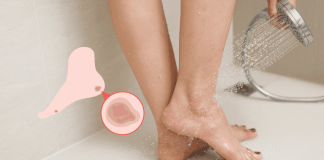 Skin Warts Public Places