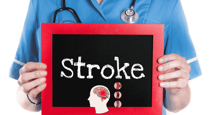 Stroke