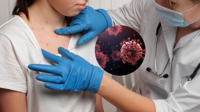 Taiwan Rubella Virus