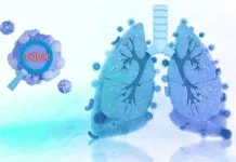 Taiwan Non Smoker Lung Cancer Nature Study Aristolochic Acid Sbs22a Pm25