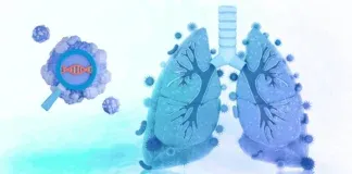 Taiwan Non Smoker Lung Cancer Nature Study Aristolochic Acid Sbs22a Pm25