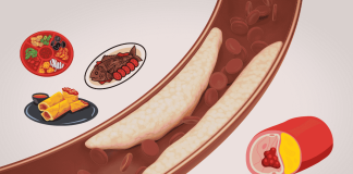 Thrombus