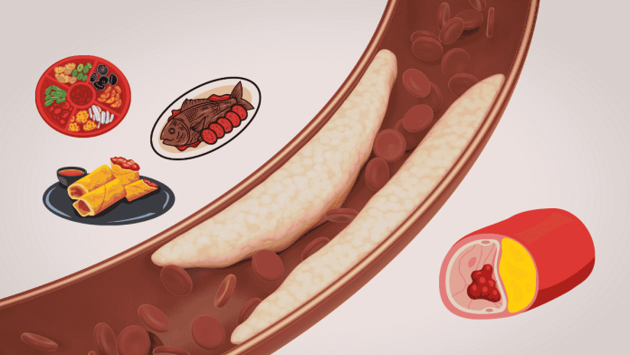 Thrombus