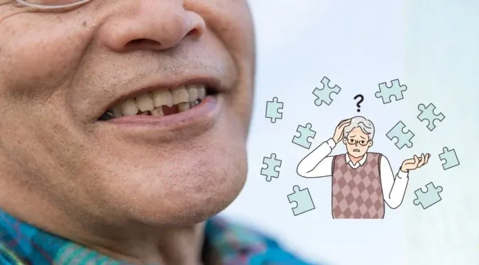 Tooth Loss Dementia Risk Chewing Brain Health
