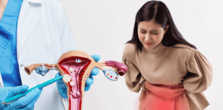 Uterine Fibroids Symptoms Treatment