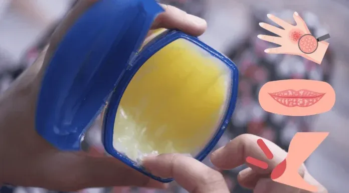 Vaseline Petroleum Jelly Hacks Uses Safety Myths Debunked