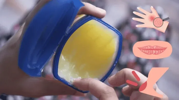 Vaseline Petroleum Jelly Hacks Uses Safety Myths Debunked