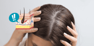 White Hair Reverse Causes Food Tips