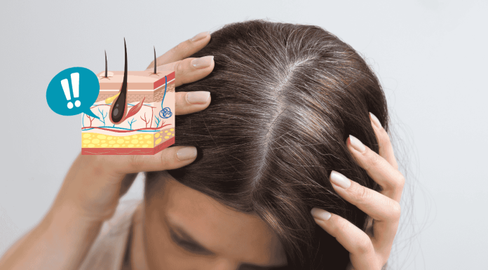 White Hair Reverse Causes Food Tips