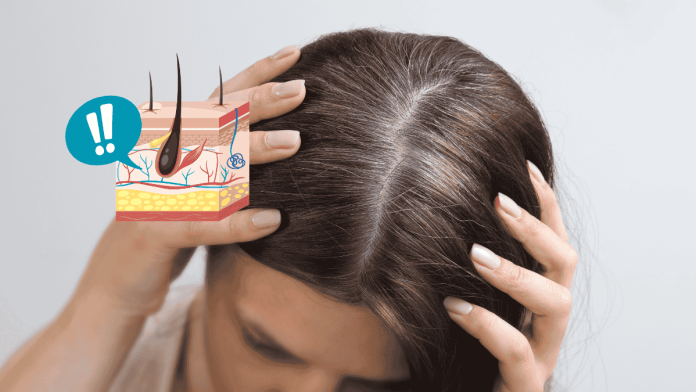 White Hair Reverse Causes Food Tips