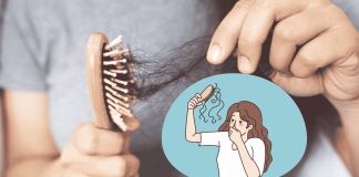 Winter Hair Loss