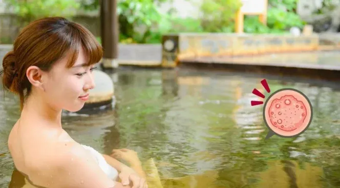 Winter Skin Itch Hot Spring Tips Skin Barrier Repair