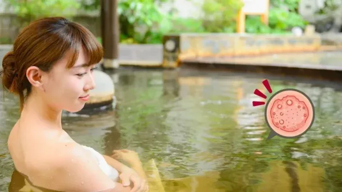 Winter Skin Itch Hot Spring Tips Skin Barrier Repair