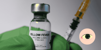 Yellow Fever