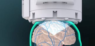 惡性腦瘤臨床試驗成功 手術導航導引聚焦超音波系統!