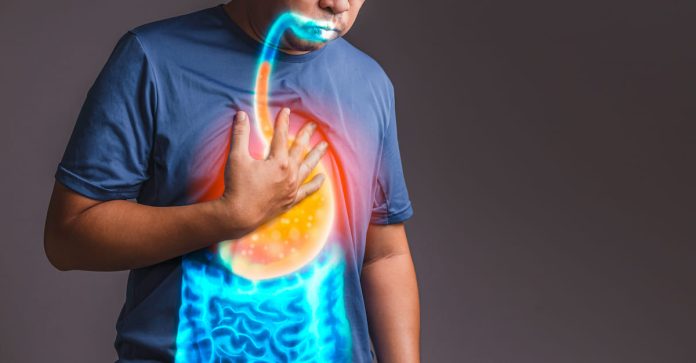 睡到一半心臟砰砰跳？不是心臟病而是 胃食道逆流 ！