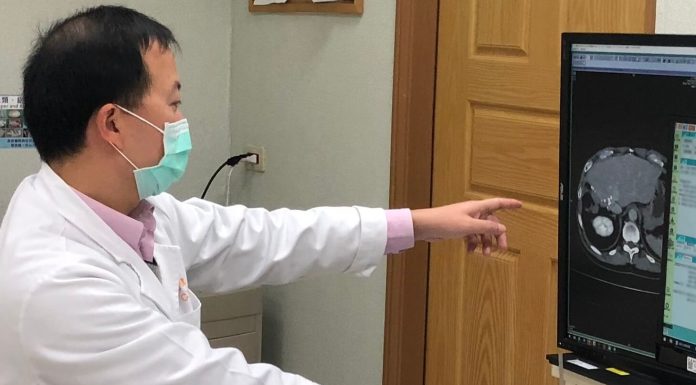 老年人肝臟切除手術 存活率與年輕患者相近(示意圖)