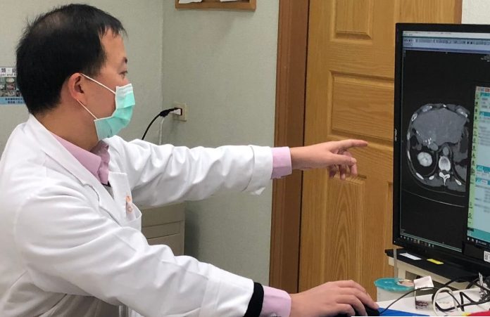 老年人肝臟切除手術 存活率與年輕患者相近(示意圖)