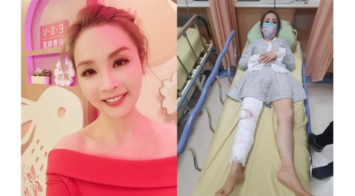 許聖梅肌少症又骨質疏鬆軟骨碎兩半!發生5現象、腿圍小於這數字要警覺