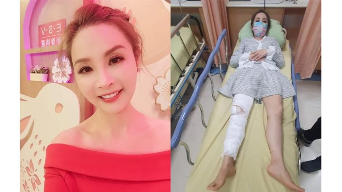 許聖梅肌少症又骨質疏鬆軟骨碎兩半！發生5現象、腿圍小於這數字要警覺