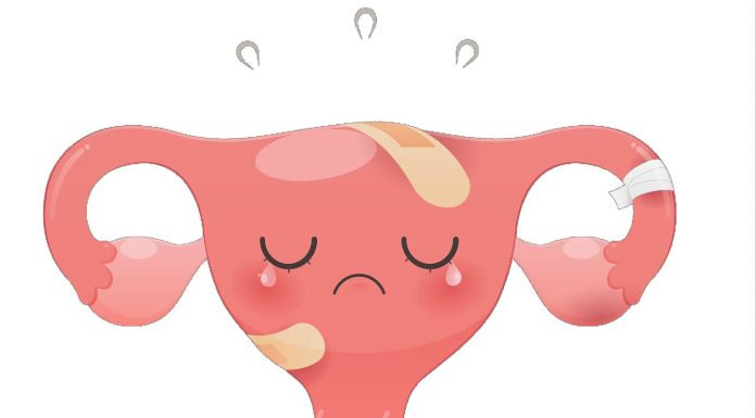 輕熟女因 子宮內膜異位症 子宮 比正常大兩倍 經痛血崩像地獄！