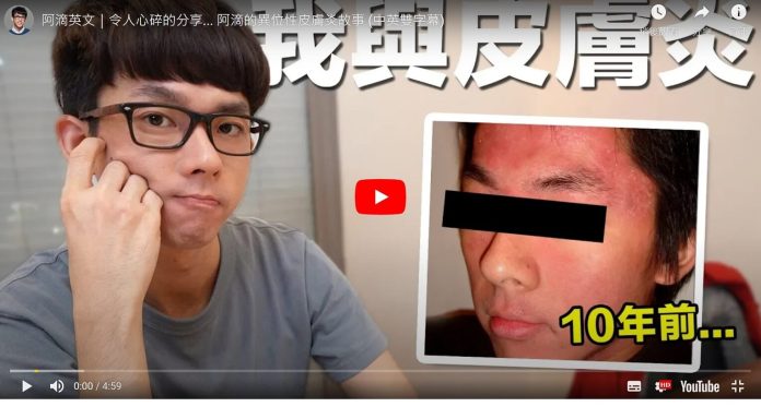 Story of atopic dermatitis